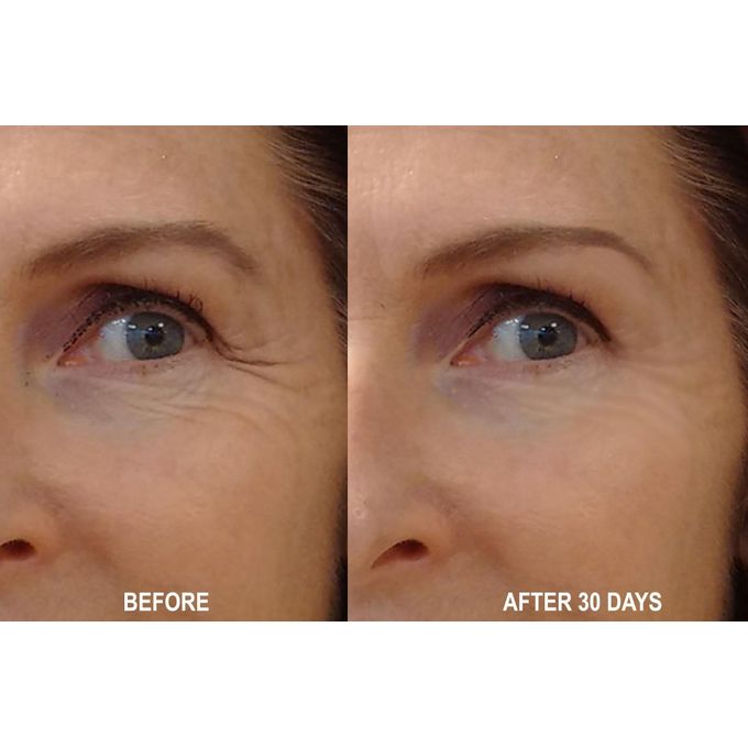 THE ORDINARY RETINOL 1% DANS DU SQUALANE 30 ML